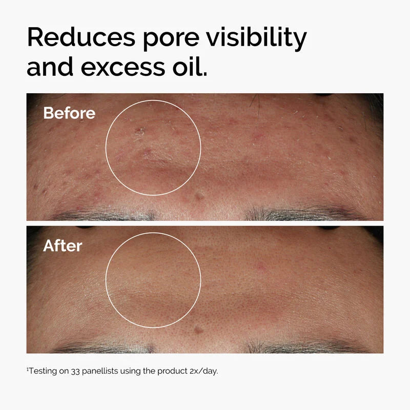 The Ordinary Niacinamide Serum 10% + Zinc 1% Supersize Serum