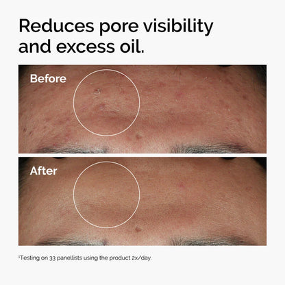 The Ordinary Niacinamide Serum 10% + Zinc 1% Supersize Serum
