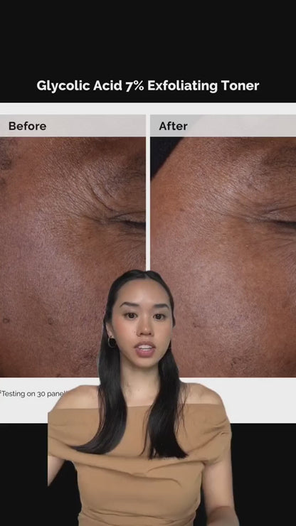 The Ordinary Niacinamide Serum 10% + Zinc 1% Supersize Serum