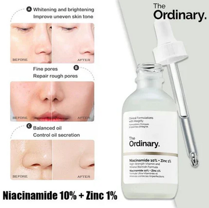 The Ordinary Niacinamide Serum 10% + Zinc 1% Supersize Serum